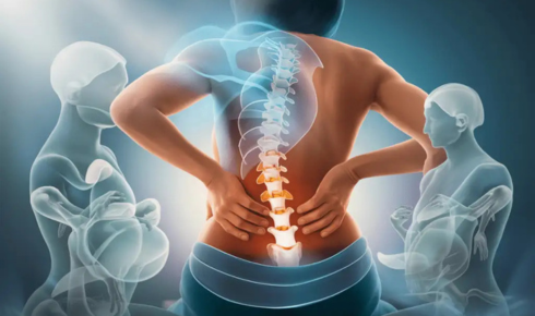 Managing Spondylosis Naturally: Regain Mobility Without Surgery